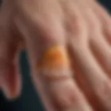 Close-up of a blister forming on a finger due to water exposure